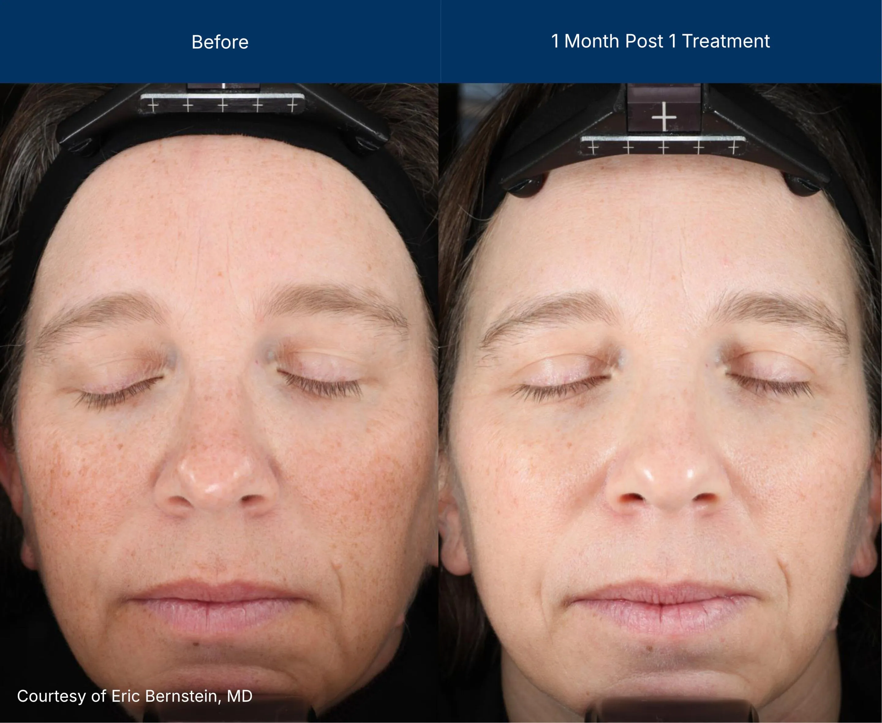 3dmiracl before and after photos