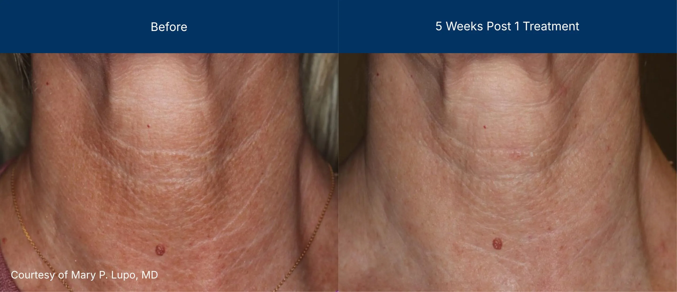 3dmiracl before and after photos