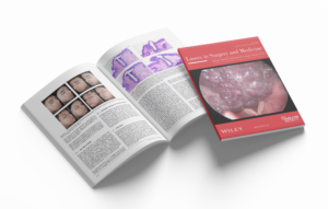 The 2910 nm Fiber Laser is Safe and Effective for Improving Acne Scarring