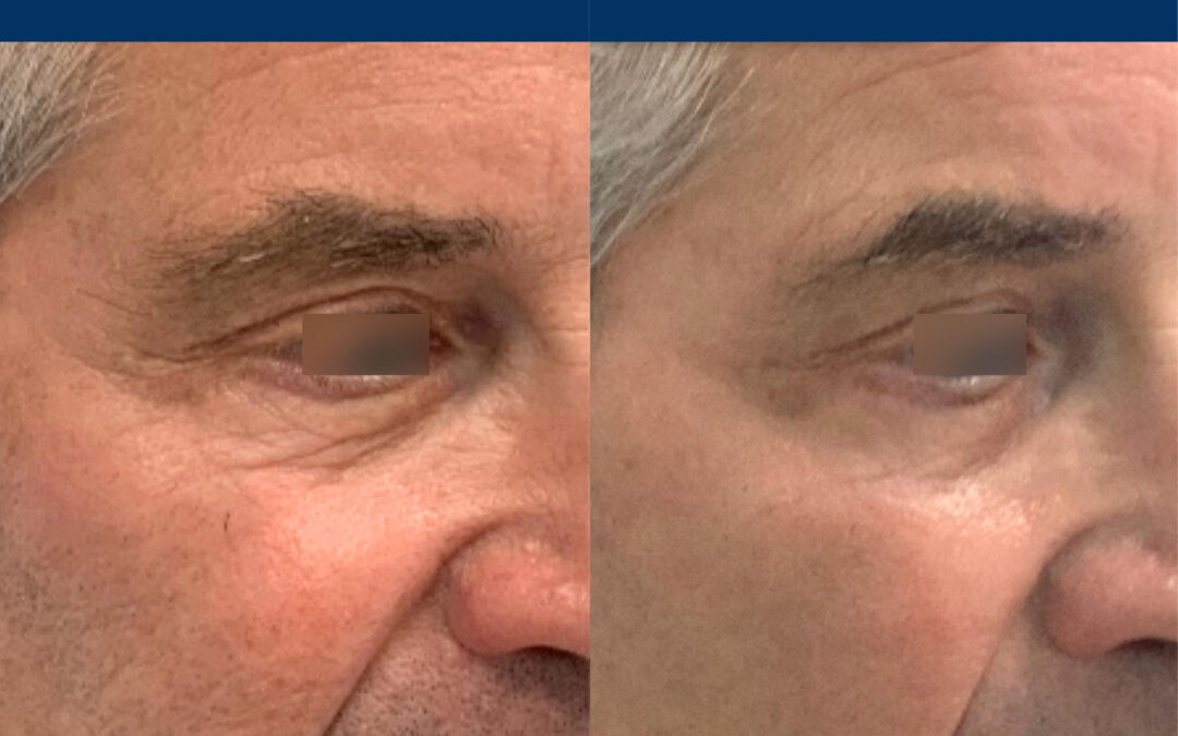 Moderate Treatment