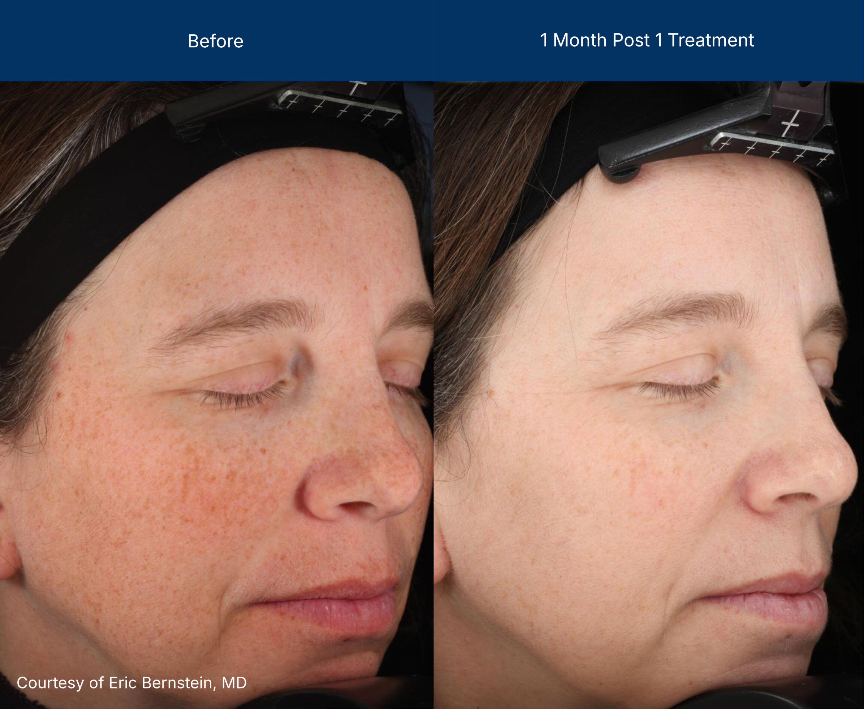 3dmiracl before and after photos