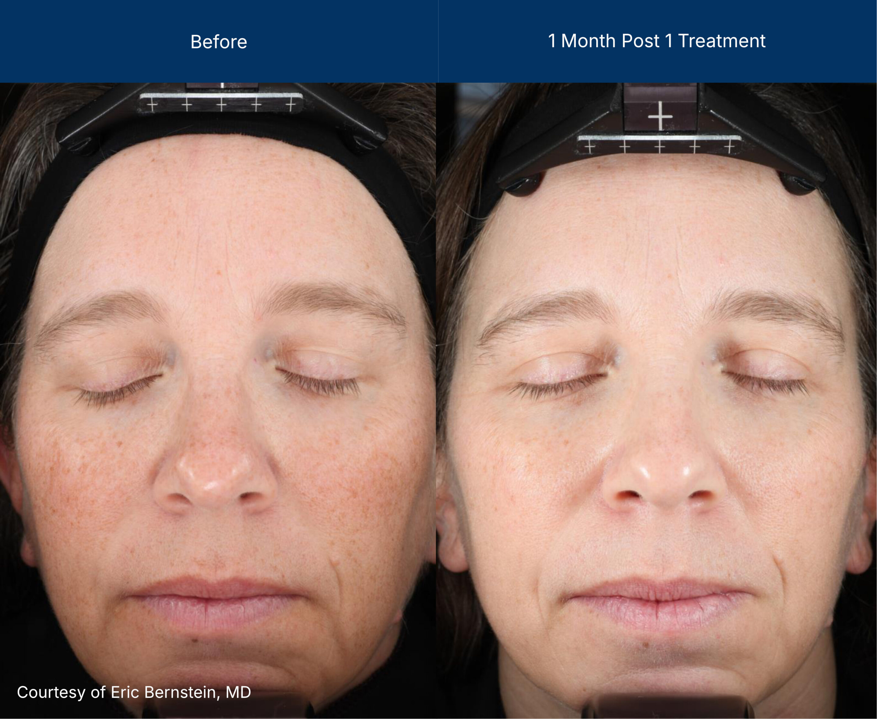 3dmiracl before and after photos