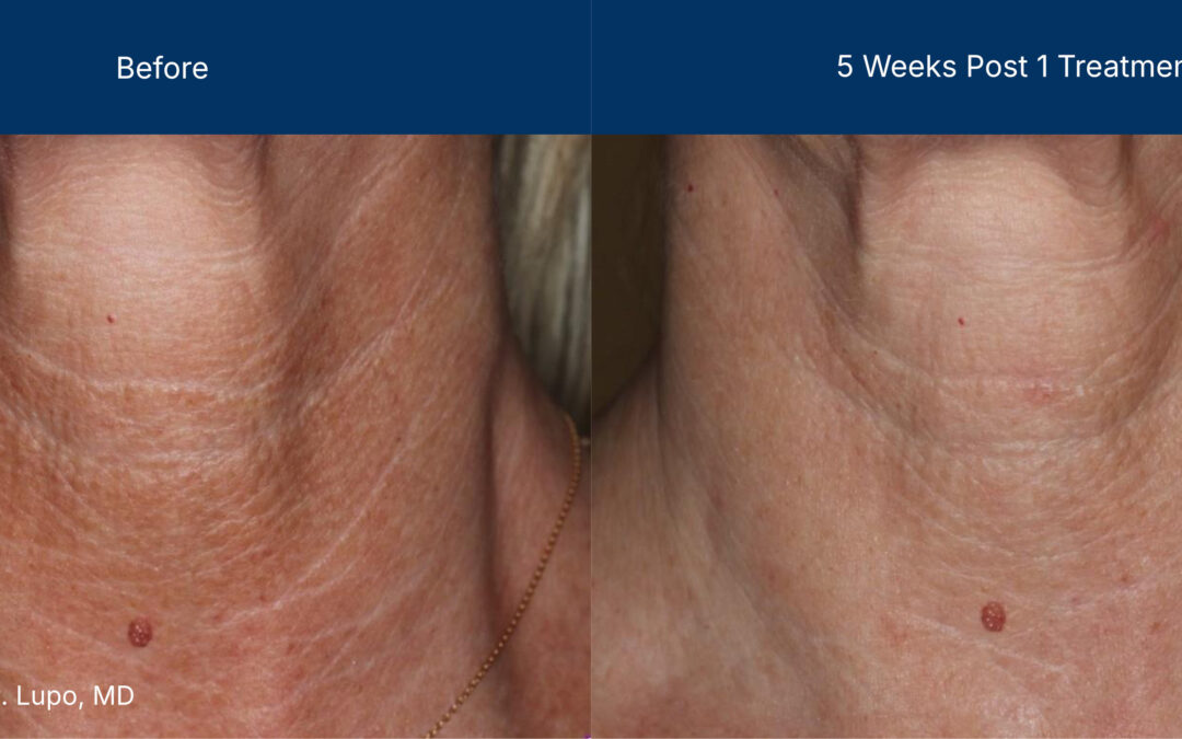 3dmiracl before and after photos
