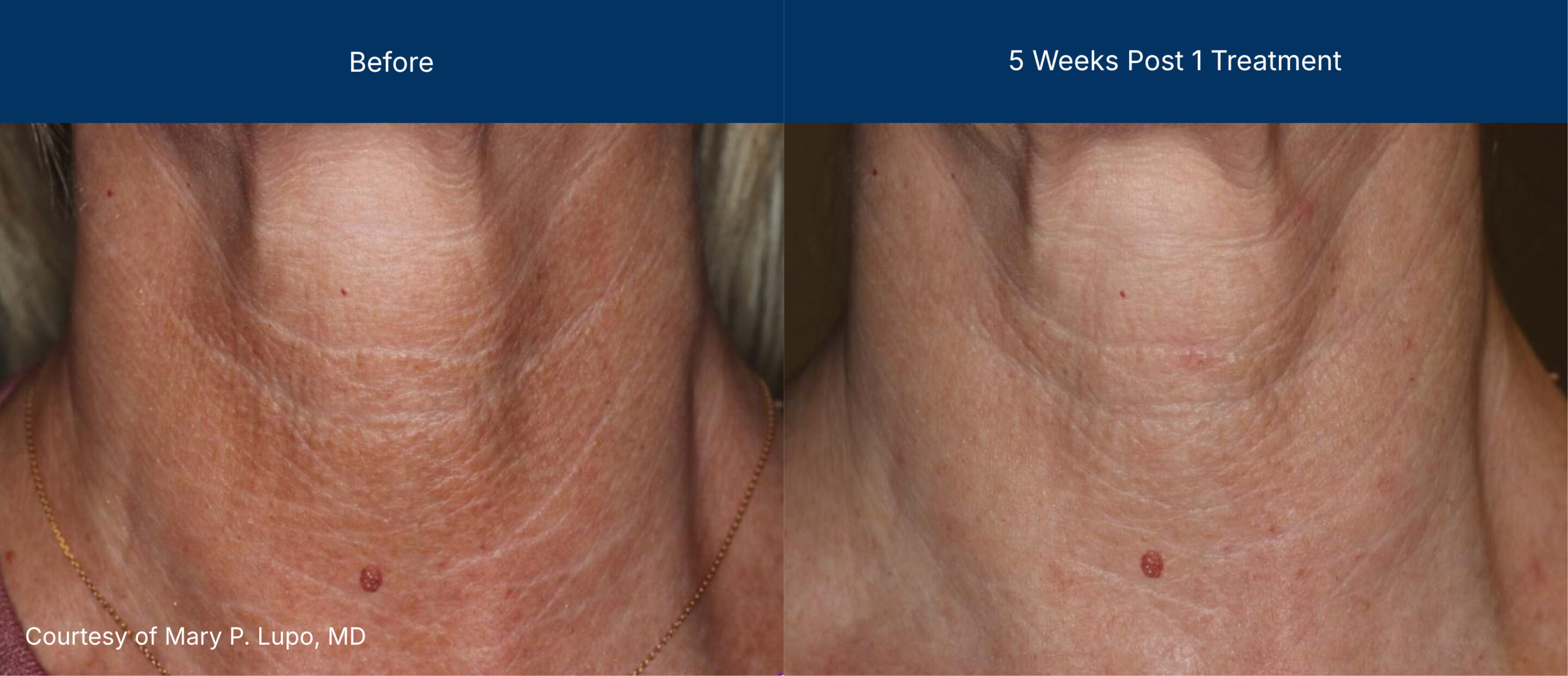 3dmiracl before and after photos