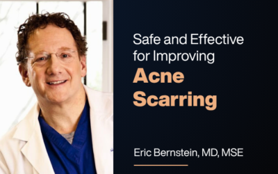 The 2910-nm Fiber Laser Is Safe and Effective for Improving Acne Scarring