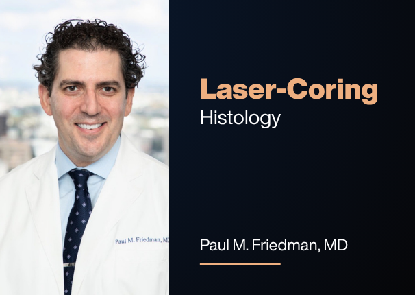 Laser-Coring™ Histological Analysis