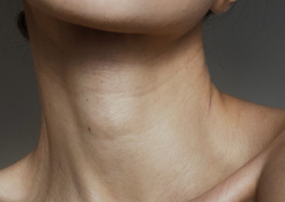 Neck Rejuvenation with Dr. Duncan and Dr. Rohrich